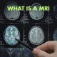 What Is an MRI and How Does It Work?